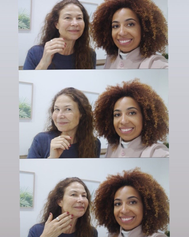 Alô pessoal, antes da temporada do sol, bora dar um plus na hidratação da pele? 

👉 Aqui, com @esteticistagabiz, da equipe de @esteticista.priscilalopes , no @pellecapellioficial 

👉 Aqui, sem filtro do insta, mas não esqueçam do FPS ao sol ☀️